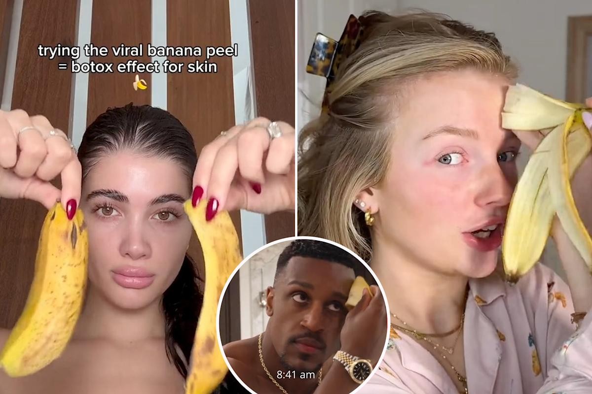 Kůra z banánu odstraní skvrny na kůži rychleji než drahé krémy - image 1